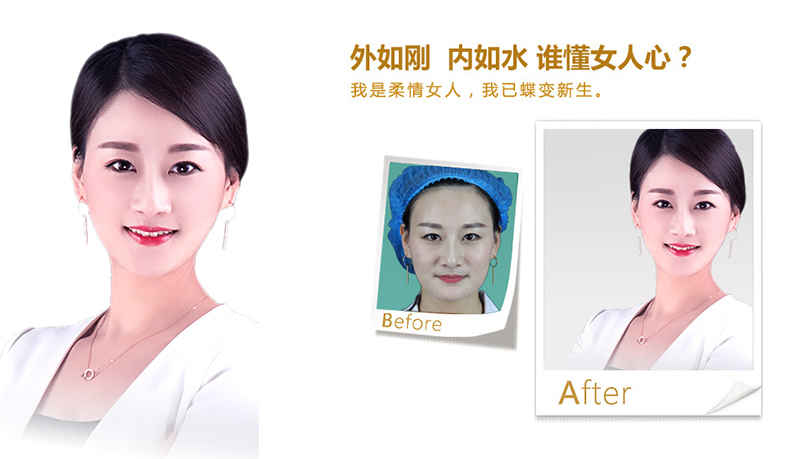 东营V脸、线雕隆鼻